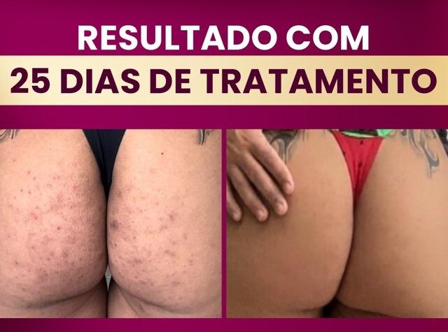 65549AF7-7ED5-4751-8552-DBCB5F4D4A8E